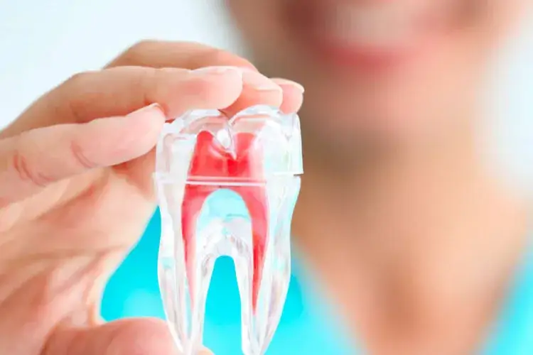 tratamientos-de-conductos-dentales-cartagena