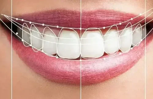 en-que-consiste-la-odontologia-estetica